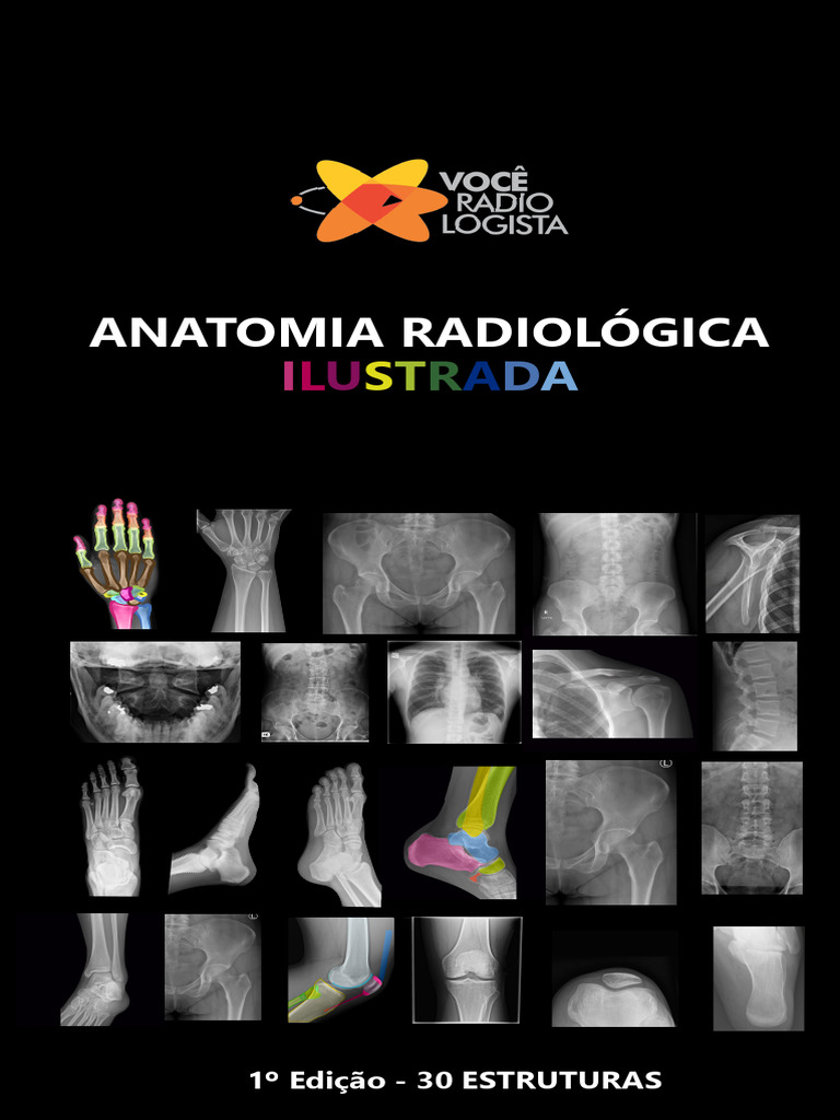 Anatomia Radiológica: Estruturas Esqueléticas | PDF | Sistema Locomotor ...