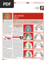 Arcos Helix Resumen