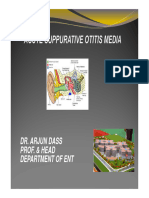 Acute Suppurative Otitis Media