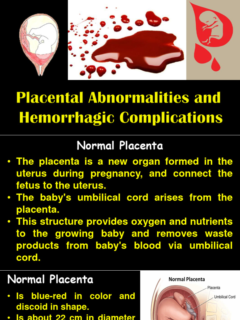 8 Placenta and Hemorrhage PDF Miscarriage Childbirth