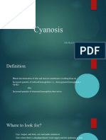 Cyanosis 3