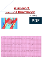 Sucessful Thrombolysis