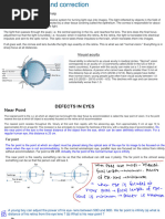 Visual Defects