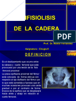 Epifisiolisis de La Cadera