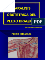Paralisis Obstetrica