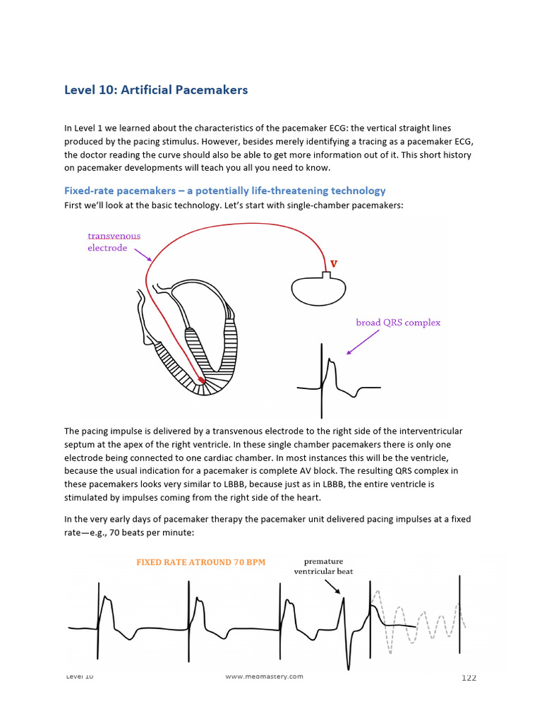 Pacemaker Innovations Explained | PDF | Artificial Cardiac Pacemaker ...
