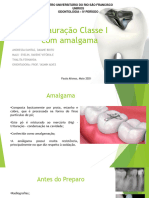 Amalgama - Odontologia