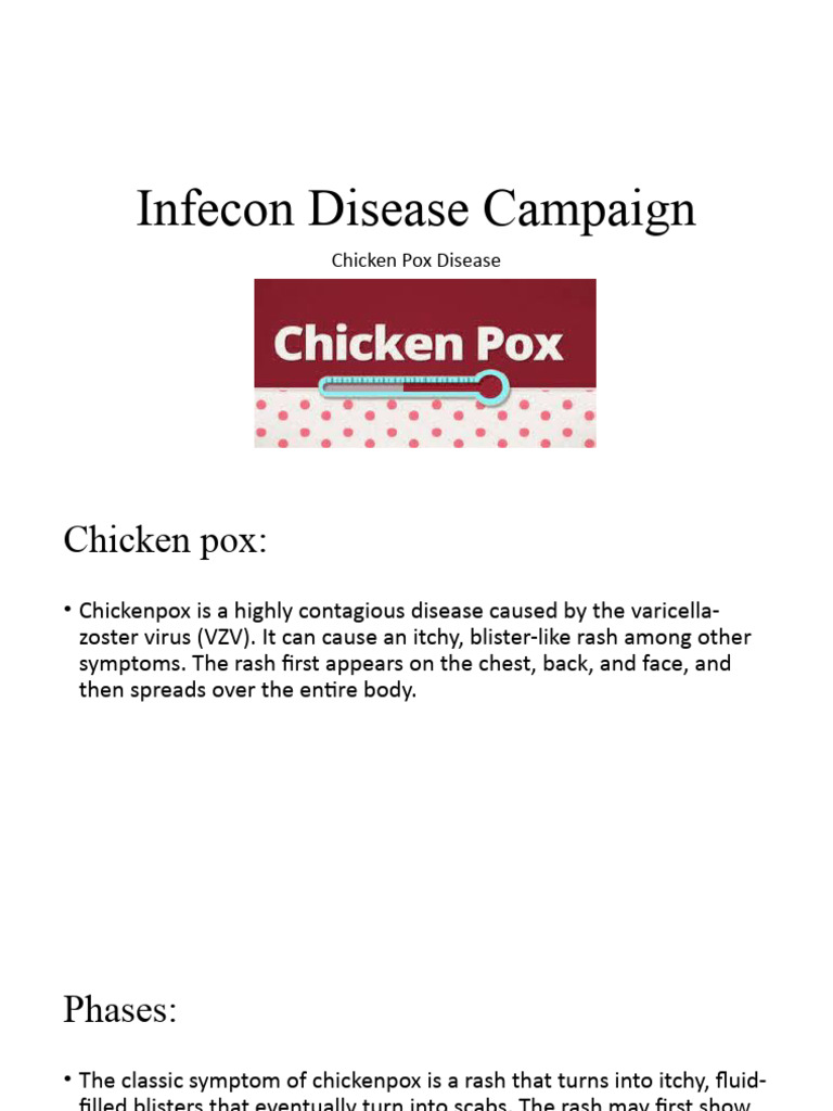 Chickenpox Overview and Care Guidelines | PDF | Wellness