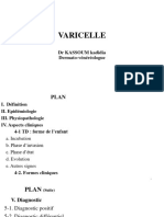 VARICELLE 