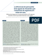 Diagnóstico Diferencial de Pericardite Aguda No Infarto Agudo Do Miocárdio Com Supradesnivelamento de Segmento ST: Relato de Caso
