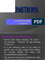 Hypermetropia