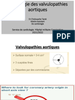 U1-C-S07. Valvulopathies Aortiques (Diapo)