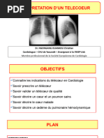 Signe de la silhouette en radiologie | PDF | Aorte | Thorax