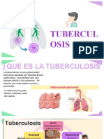 Tuberculosis