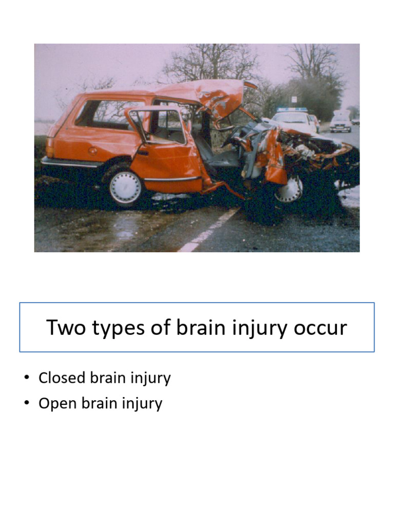 Open vs Closed Head Injury Overview | PDF | Traumatic Brain Injury ...