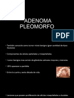 Adenoma Pleomorfo