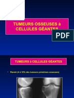 H-12-Tumeurs A Cell Geantes