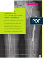 Endoplastyka Stawu Biodrowego-Rehabilitacja