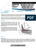Il Gomito Del Tennista Epicondilite Laterale
