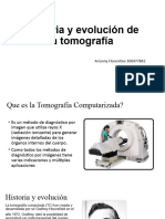 Historia y Evolución de La Tomografía