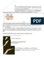 Nerve Gliding Exercise in CTS