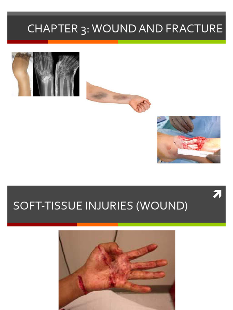 Chapter 3 Wound Pdf Injury Wound