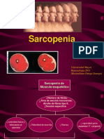 Sarcopenia