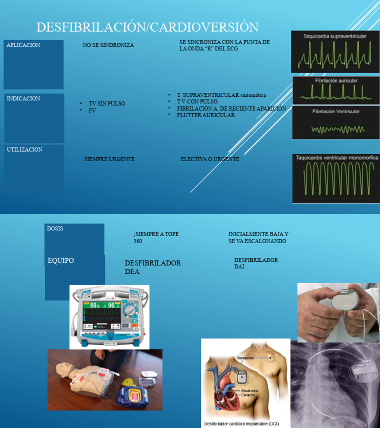 Desfibrilacion - Cardioversion | PDF
