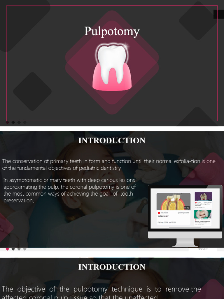 Pulpotomy Procedure for Primary Teeth | PDF | Dentistry | Dental Anatomy