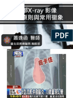 胸部X-ray 影像 判讀原則與常用徵象