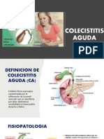 Colecistitis Aguda