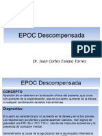 EPOC