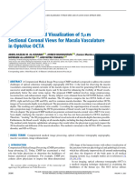 Reconstruction and Visualization of 5m Sectional Coronal Views For Macula Vasculature in OptoVue OCTA