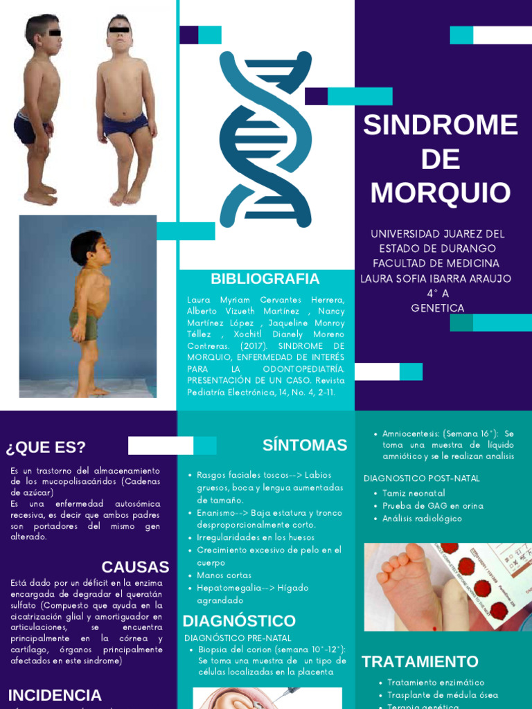 Síndrome de Morquio: Diagnóstico y Tratamiento | PDF | Medicina CLINICA ...