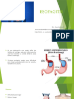 Esofagitis Medicina Interna Estomatologica