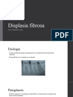 Displasia Fibrosa