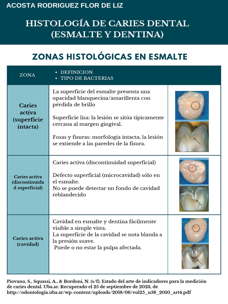 Zonas de Caries: Activa e Inactiva | PDF | Esmalte de dientes | Anatomía
