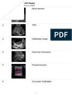 Pathology Ultrasound