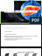 Lesiones Focales Hepáticas Ss