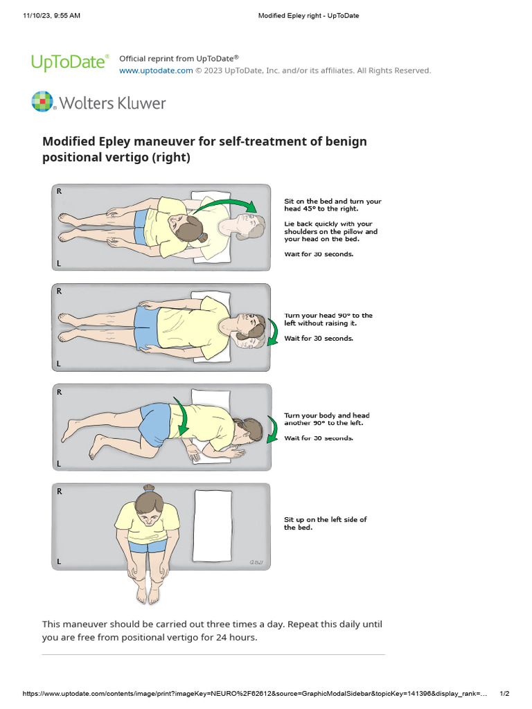 Modified epley right uptodate pdf