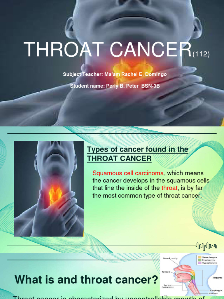 Oral And Throat Cancer Pdf Head And Neck Cancer Cancer 