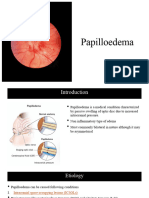 Papilloedema: Shreya Kulkarni 20MUG076