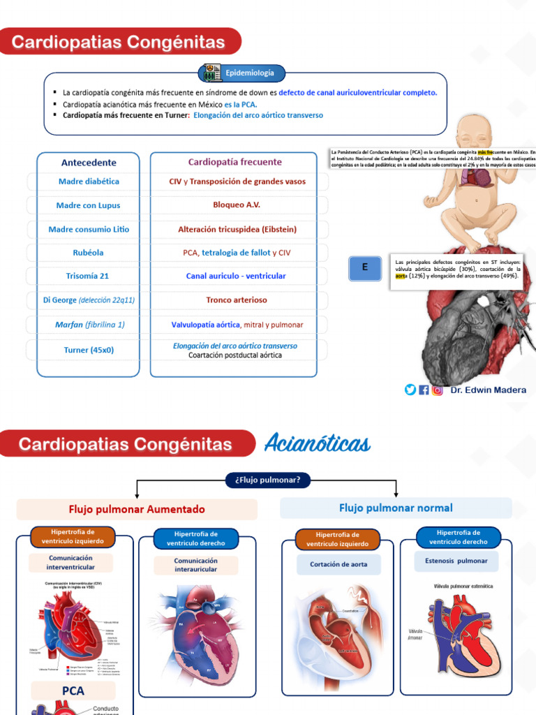 Cardiopatias Congénitas | PDF | Defecto cardiaco congenito | Sistema ...