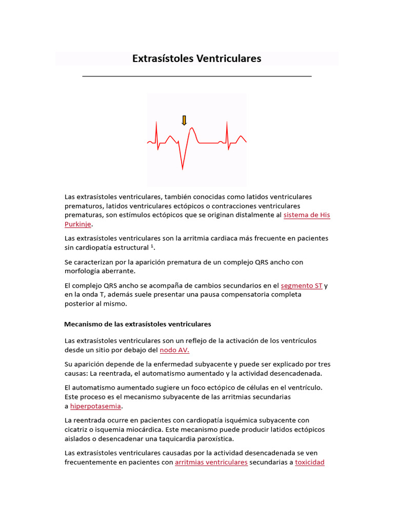 Clasificación y Mecanismos de Extrasístoles Ventriculares | PDF ...