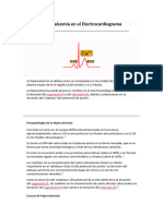 Hipercalcemia en El Electrocardiograma