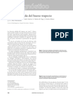 Diagnóstico: Fractura Aislada Del Hueso Trapecio