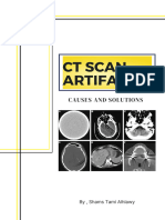 CT Scan Artifacts 1681725878