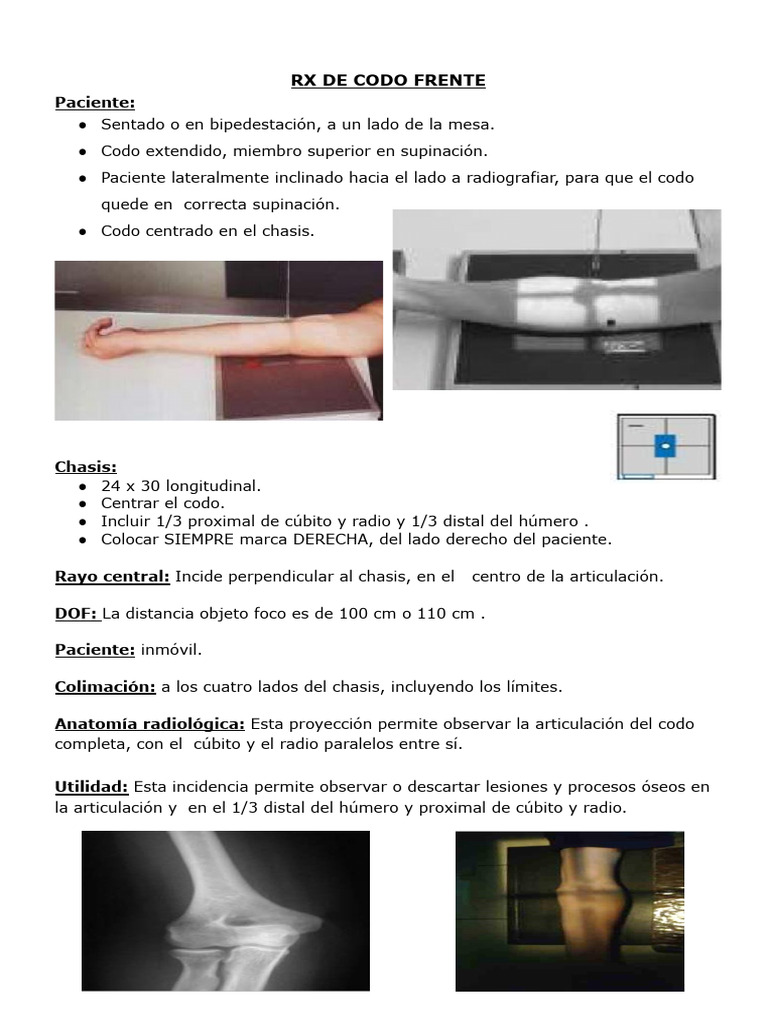 Proyecciones Radiológicas del Codo | PDF | Codo | Articulaciones
