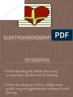 Elektrokardiografi (EKG)-NEW