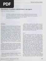 Macrodontia of Maxillary Central Incisor